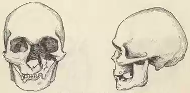 chapter-II-plate3c